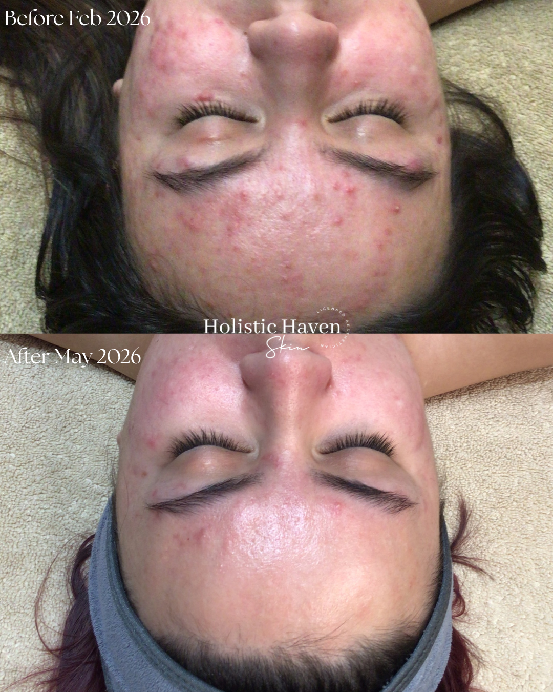 Client skin before February 2026 and after May 2026