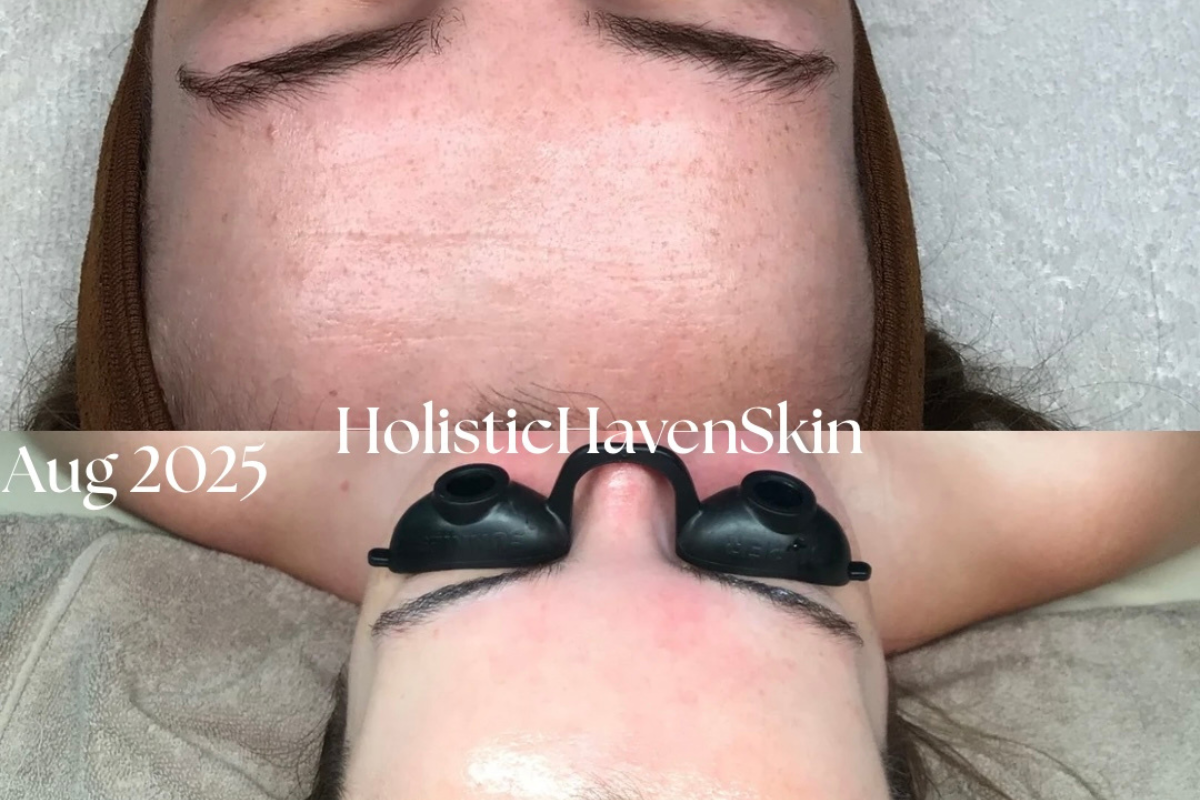 Client skin progress through August 2025