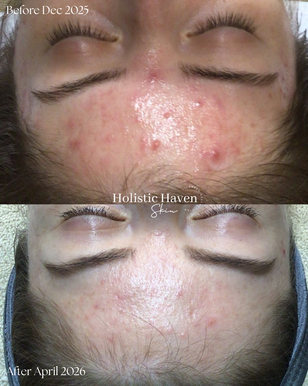 Client skin before December 2025 and after April 2026