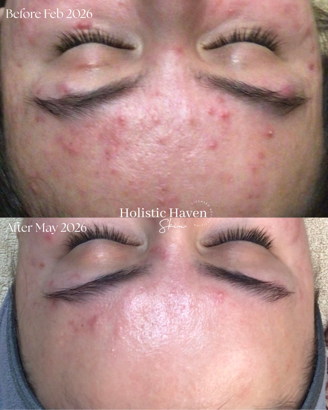 Client skin before February 2026 and after May 2026